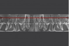 Termoskupljajuća plastična providna folija širina 65,8 mm - dužina metar (f 40)