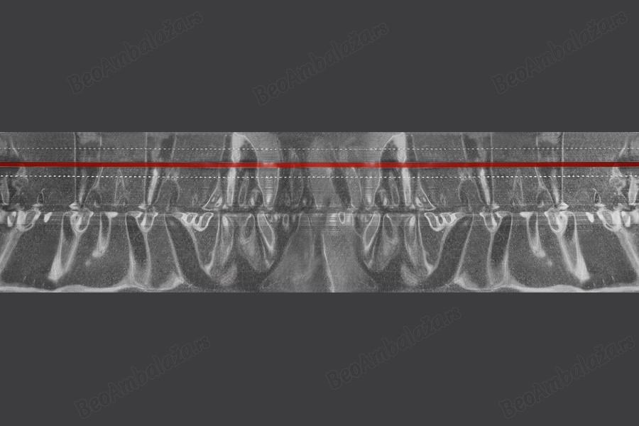 Termoskupljajuća plastična providna folija širina 65,8 mm - dužina metar (f 40)-slika_proizvoda